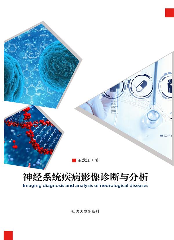 神经系统疾病影像诊断与分析